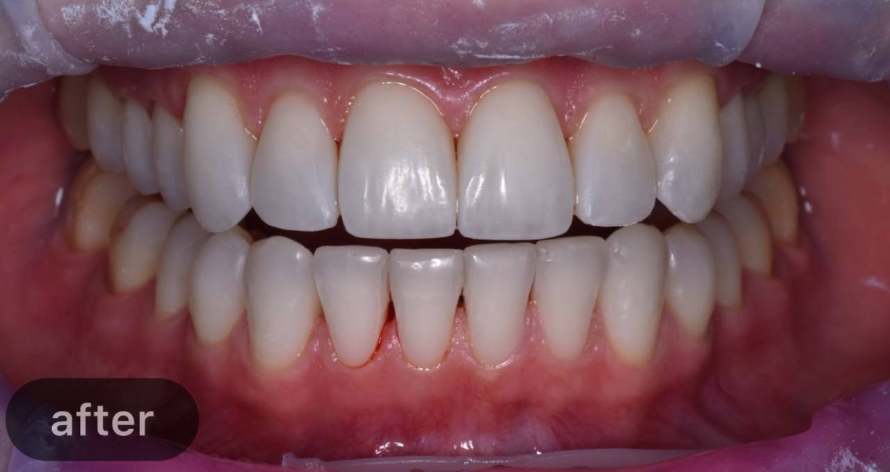 dental hygiene