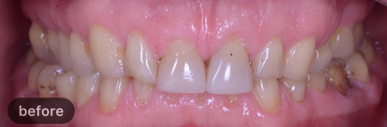 Comprehensive treatment