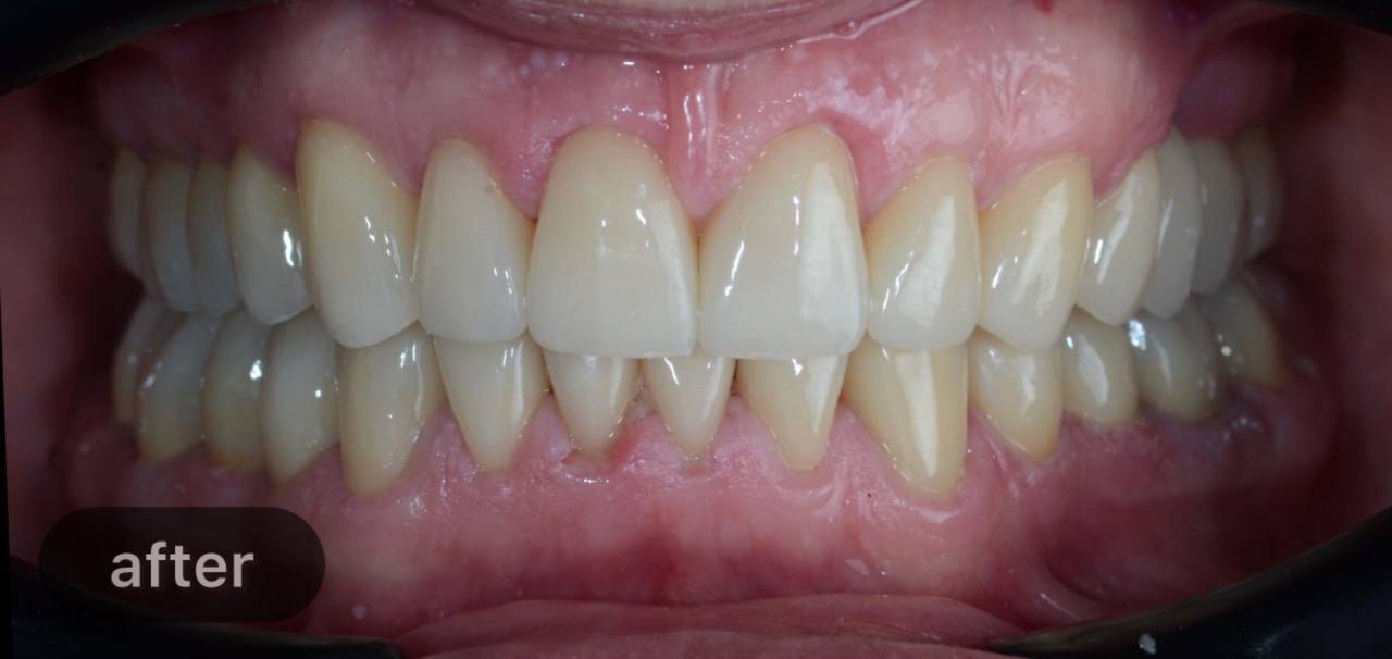 Comprehensive treatment