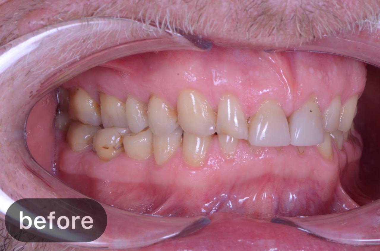 Comprehensive treatment