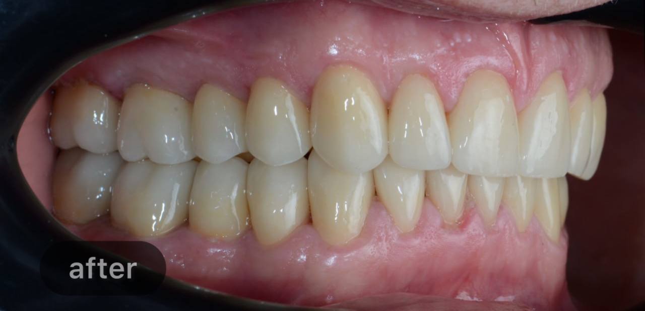 Comprehensive treatment
